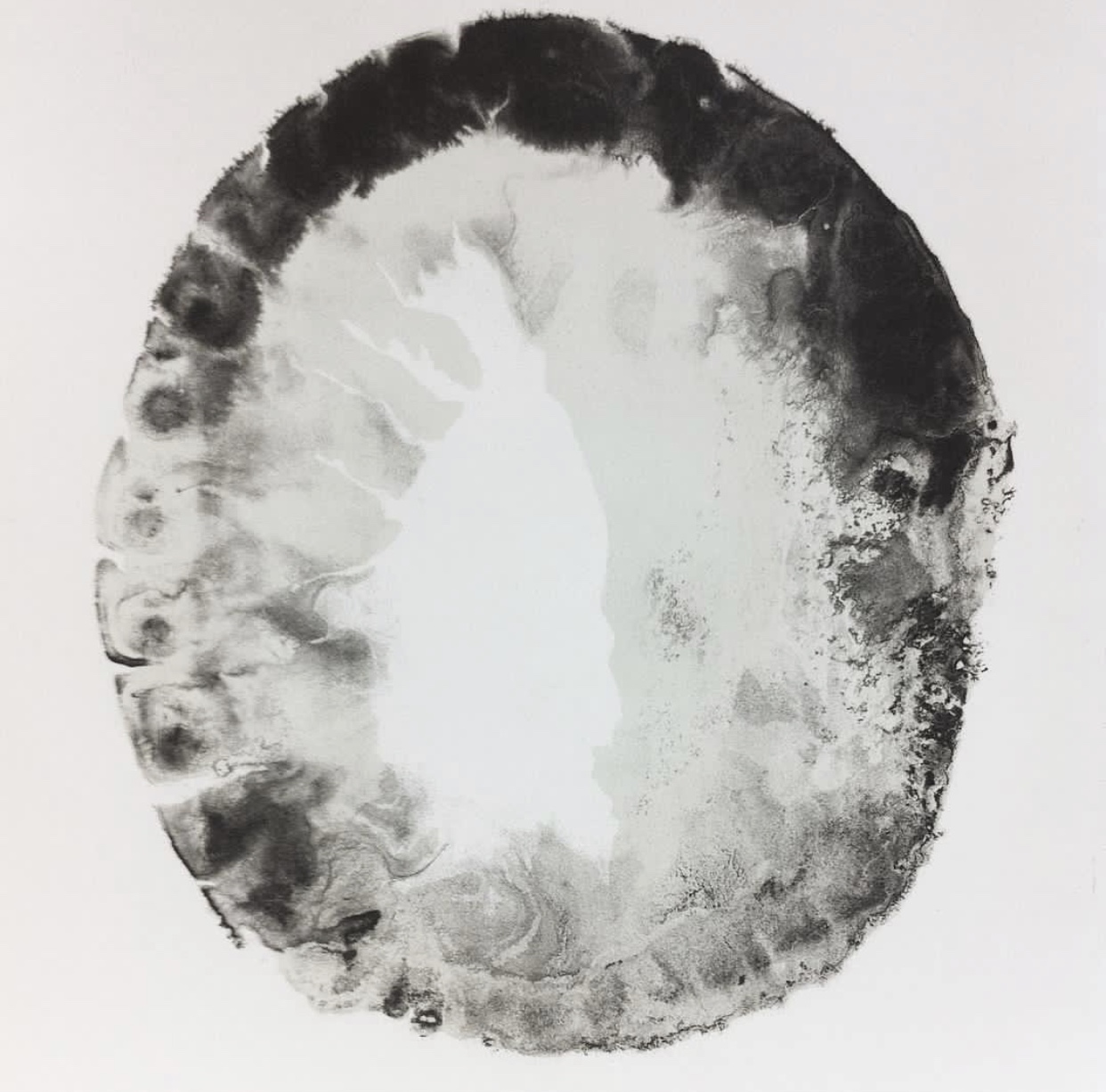 Left Image